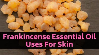 Frankincense Oil for Skin